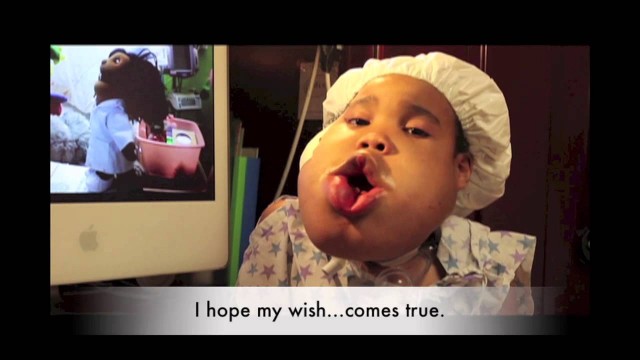 Aleazia, who has cystic hygroma, and his Make A Wish video